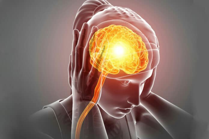 Image showing a woman with migraine