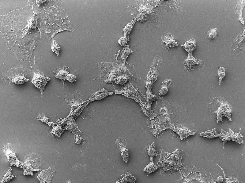 Cancer cells killed by programmed Photorhabdus virulence cassettes