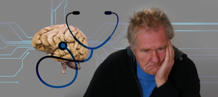 Image showing Alzheimers disease