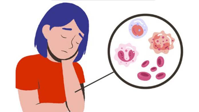 Image showing a girl in depression with immune dysfunction