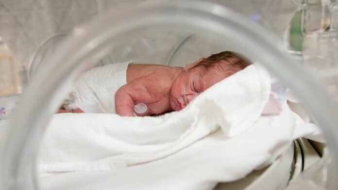 Image showing premature baby