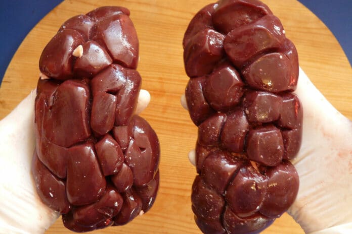 Image illustrating kidney