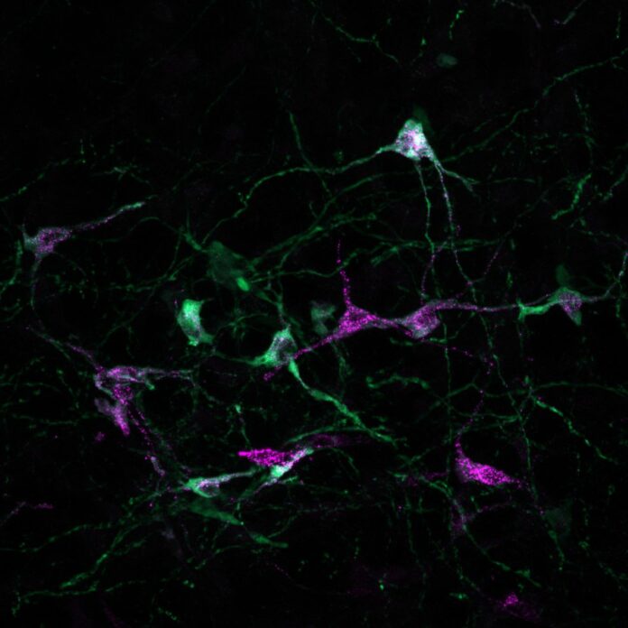 Purinergic neurons