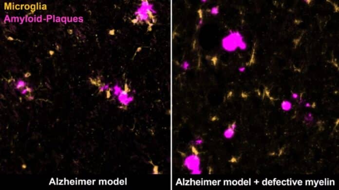 Image showing Alzheimer model.
