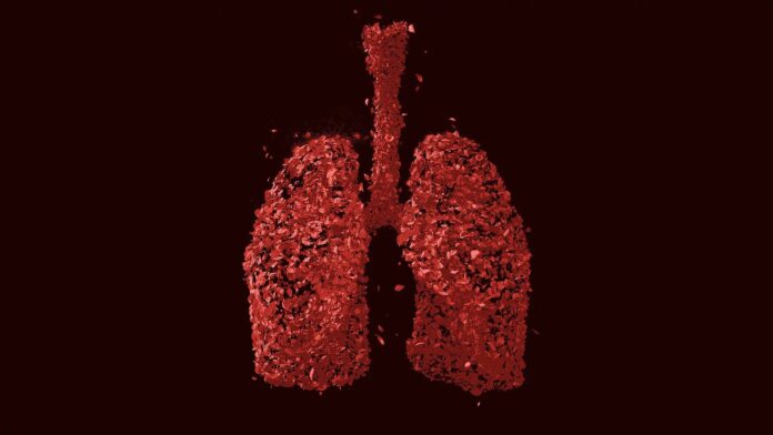 Image showing lungs