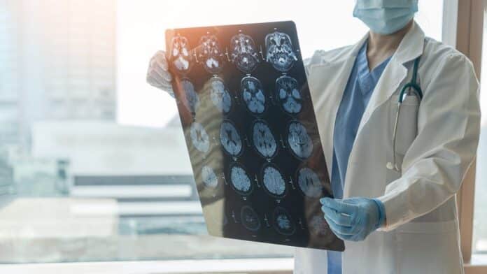 Image showing Brain disease diagnosis with medical doctor seeing Magnetic Resonance Imaging (MRI) film.