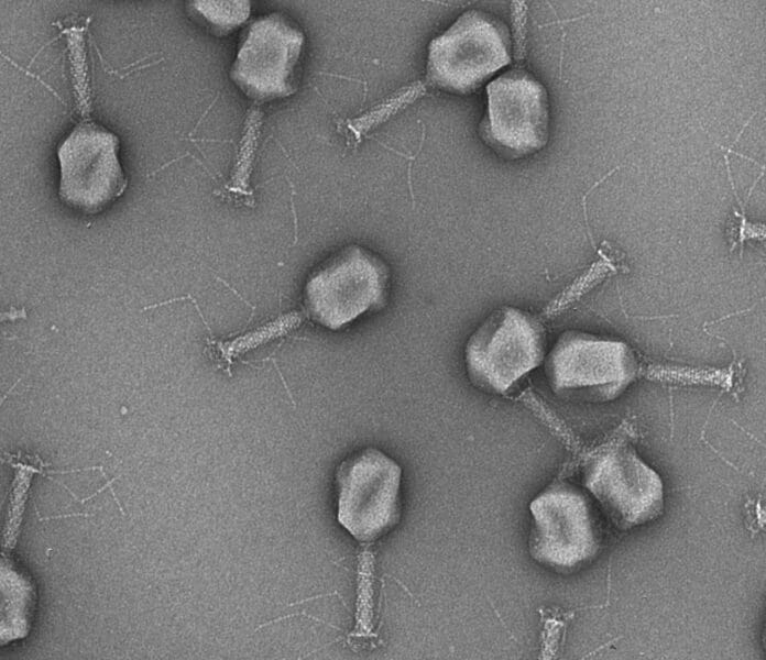 Image showing Electron micrograph of phages.