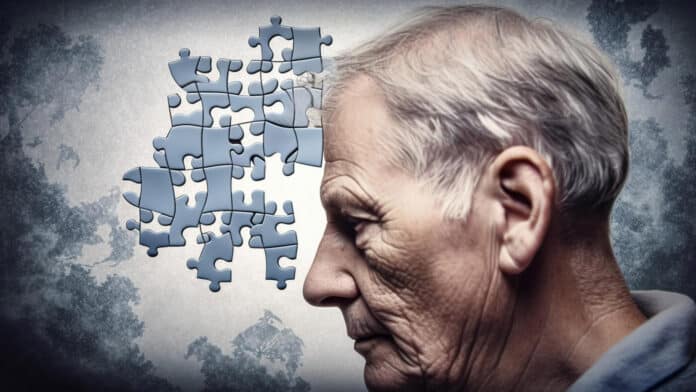 Image showing Alzheimer's man.