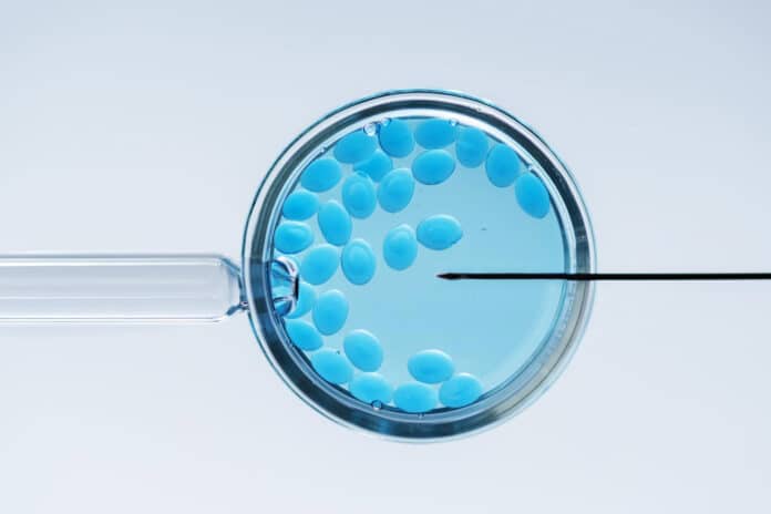 Image showing vitro fertilizations concept..