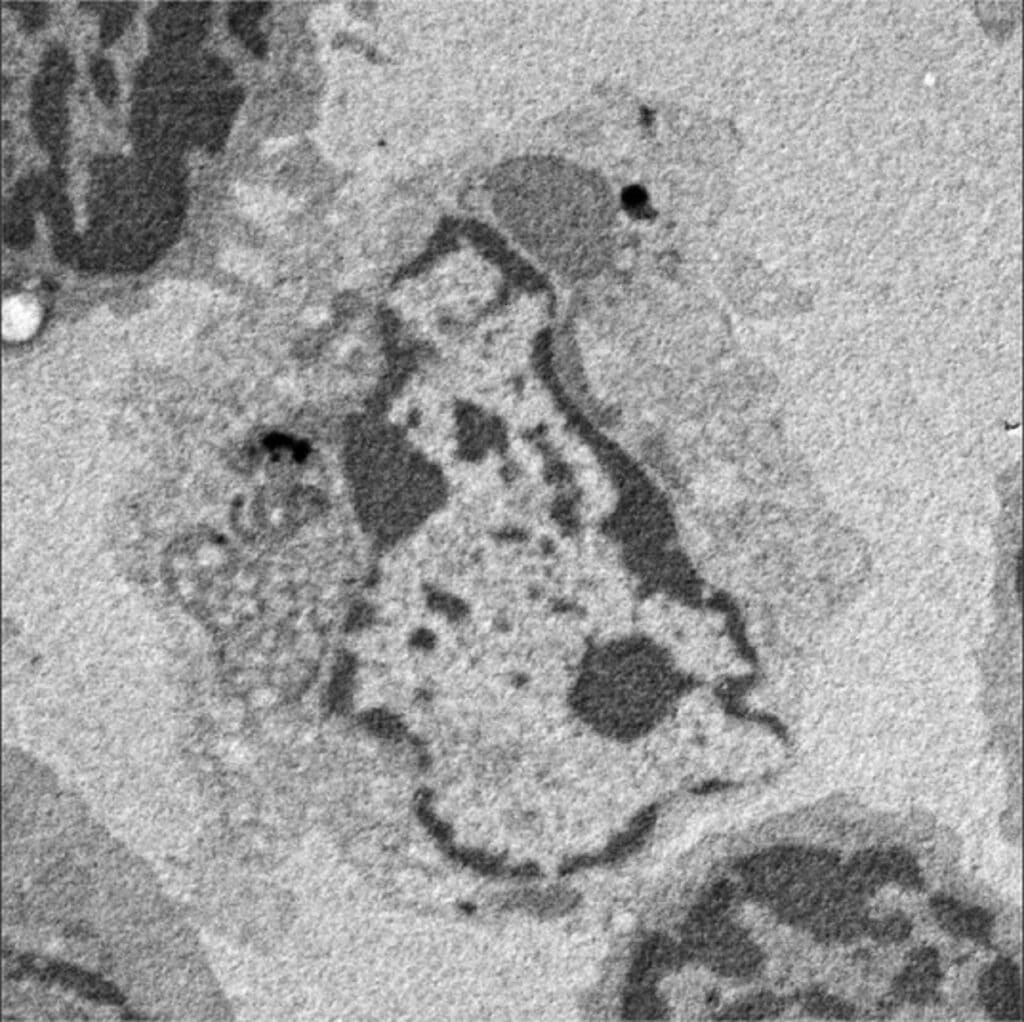 Image showing A dead T cell. It was known that T cells are killed when they lack a surface molecule called CD47. Now, a research group at Kobe University has identified the culprit and discovered an unexpected capability of the immune system that has potential for cancer treatment.