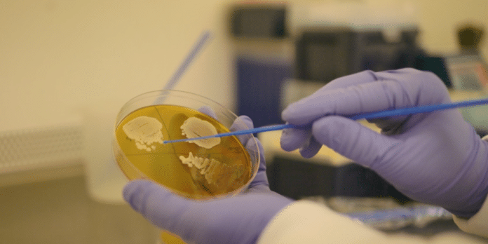 Image showing A researcher selects a colony of yeast from an agar plate.