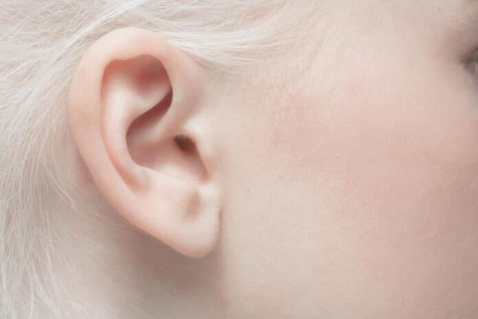 Image showing ear