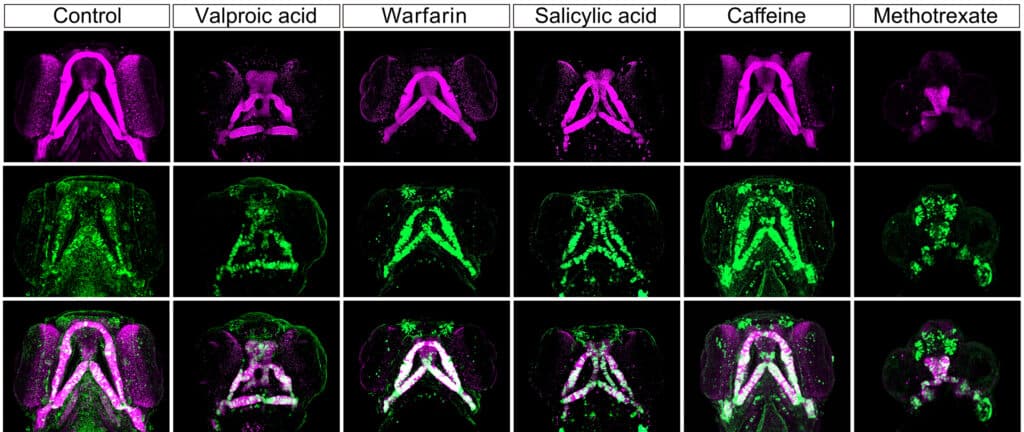 image showing Craniofacial anomalies in zebrafish. These images show the development of a zebrafish’s craniofacial cartilage (via fluorescent staining) 96 hours post fertilization, comparing typical development (on the far left) with the effect of the five drugs tested.