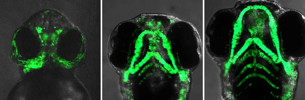 Image showing Developing features. These fluorescent images of live zebrafish embryos show the movement, assembly and growth of cartilage-forming cells at 48, 72 and 96 hours post fertilization.