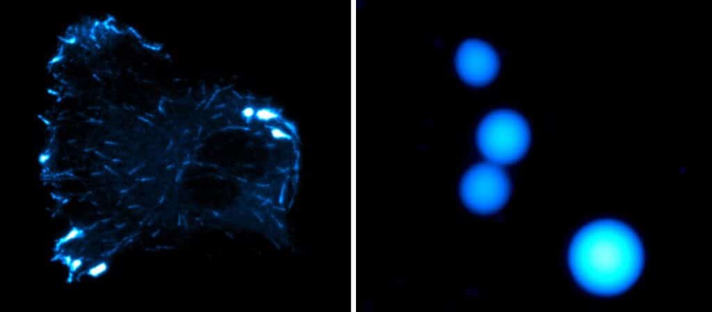 Image showing Left: cell overexpressing CLIP-170. Right: in vitro CLIp-170 condensates.