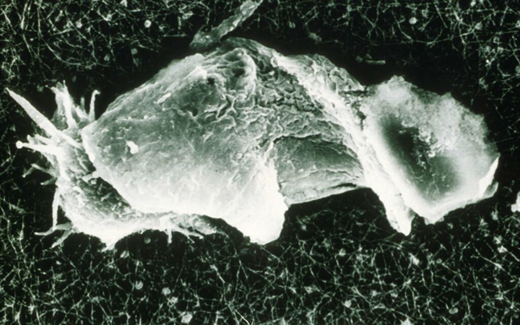 Image showing Acanthamoeba shown excysting.