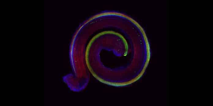 Image showing Fluorescence microscopic image of a murine cochlea: the hair cells are marked in green, the cell skeleton in red and the cell nuclei with genetic material in blue.