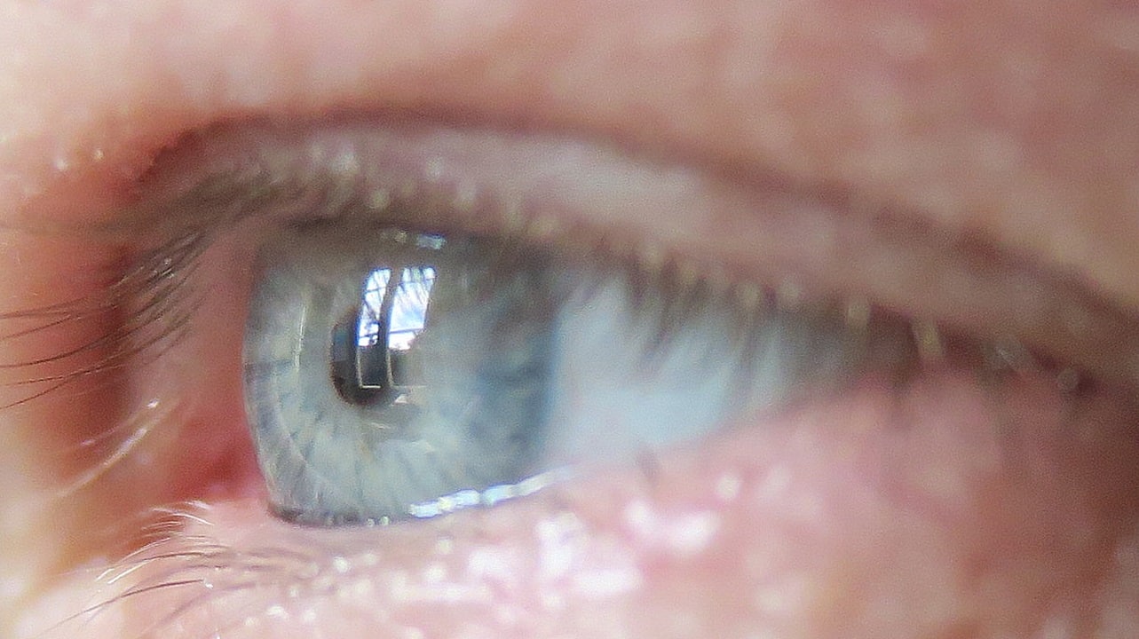 Image showing The eye is our only window into the body ..." says Anna Herland, one of the study's authors.