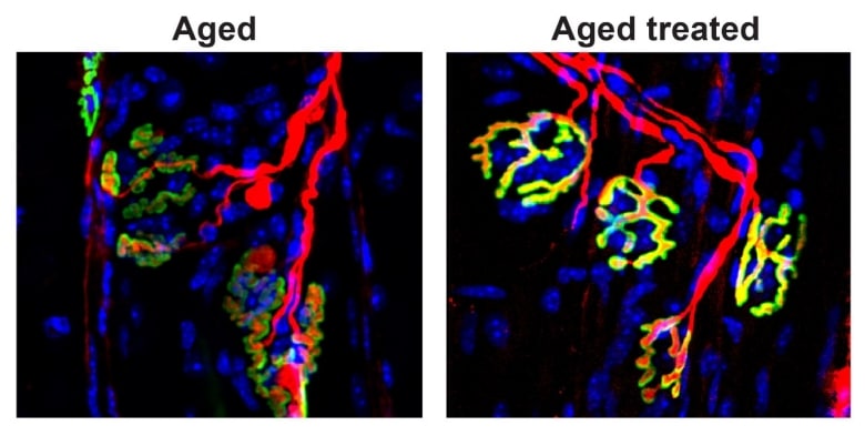 Image showing Neuromuscular junctions become misshapen and dysfunctional as mice age. The connections between a motor neuron (red) and pretzel-like receptor clusters (yellow-green) on the muscle are more robust in old mice treated with an inhibitor of the gerozyme, 15-PGDH (right panel), than in control mice (left panel). Contact by the nerve is essential for muscle contraction; this contact can also be lost due to trauma, disuse and muscle wasting disorders.