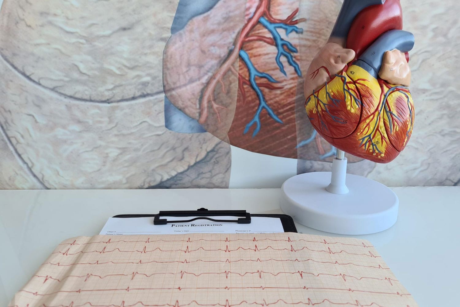Heart cardiovascular disease and electrocardiogram of patient