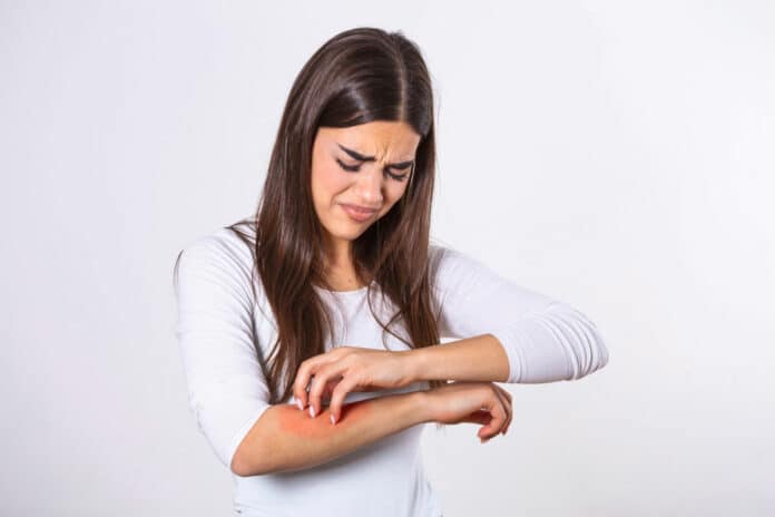 Young woman scratching her arm