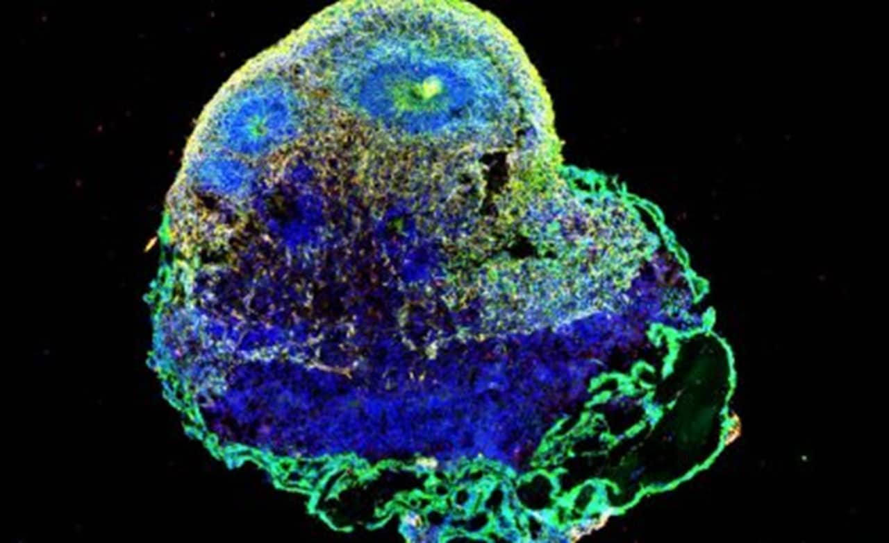 Image showing A brain organoid as seen under a microscope.