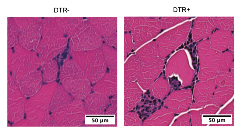 Image showing The hind leg muscles of mice lacking Treg cells (right) showed prominent signs of inflammation after regular exercise, compared with those of mice with intact Tregs (left). The research showed that this uncontrolled inflammation negatively impacted muscle metabolism and function. 