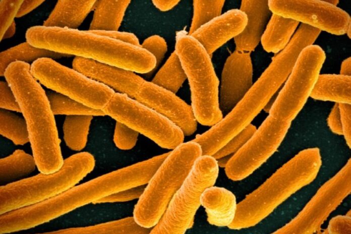 Image showing Microscopic image of E. coli bacteria.
