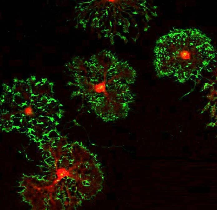 Image showing Oligodendrocyte precursor cells (OPCs) that the Gibson lab cultures in vitro and differentiates into myelinating oligodendrocytes..