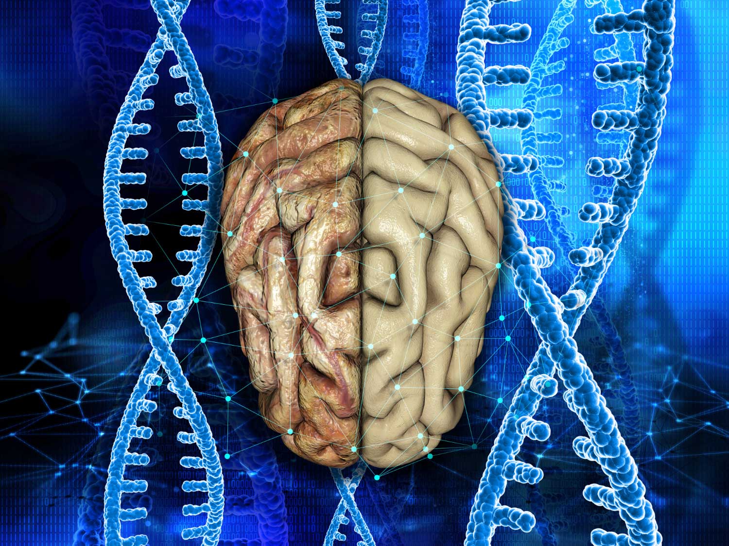 3d medical background with healthy and unhealthy brain on dna strands
