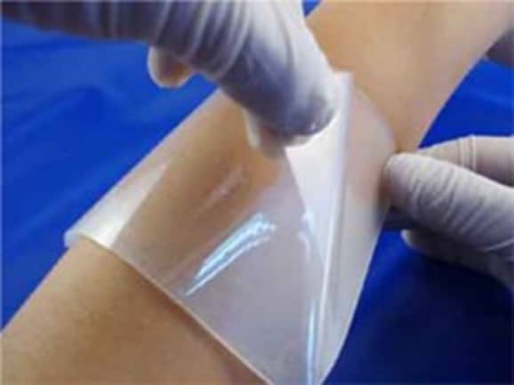 Hydrogels are a promising approach for treating wounds.