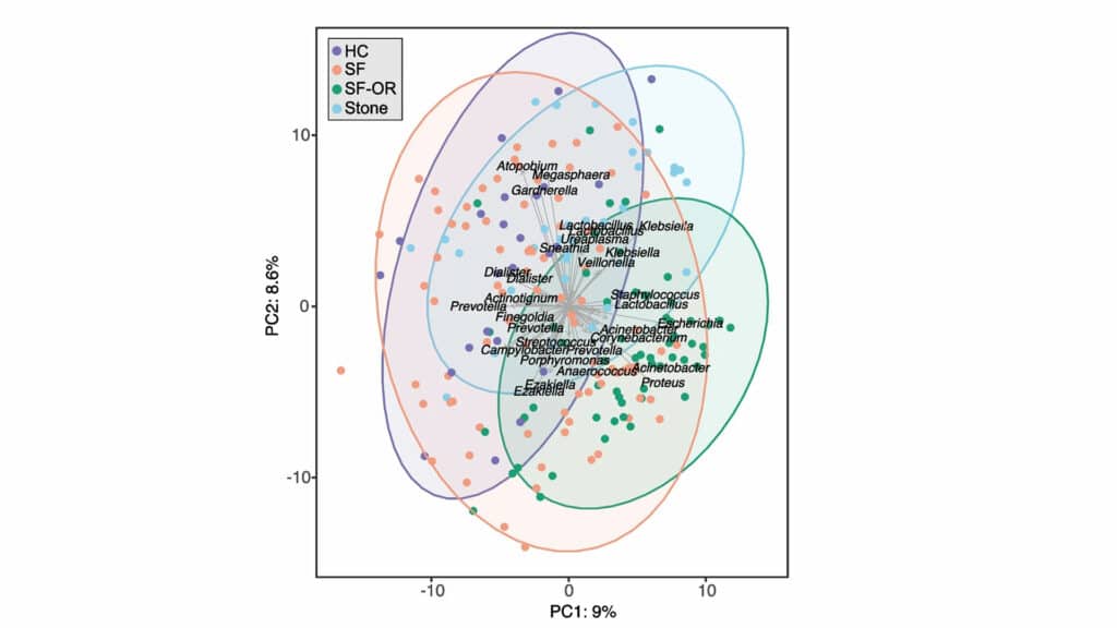 Image showing Differences in the microbiome composition in the urine of healthy controls (HC), stone formers (SF), stone formers during surgery (SF-OR) and the kidney stones themselves (Stone) are seen in this analysis. 