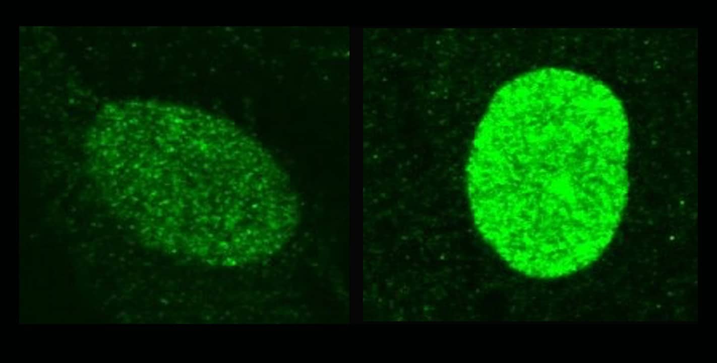 Image showing These microscope images show how interferon in the nucleus raises levels of the protective protein IFI16 (stained green) from low background levels (left) to the higher levels needed to resist herpes infection (right).
