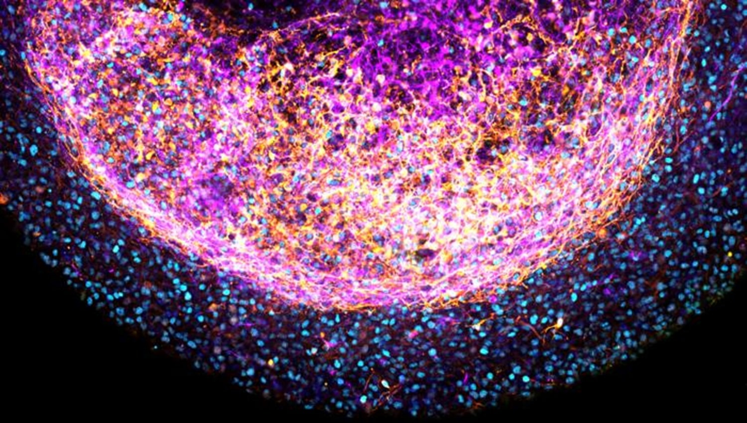 Scientists developed ‘Mini Brains’ from human fetal brain tissue thumbnail
