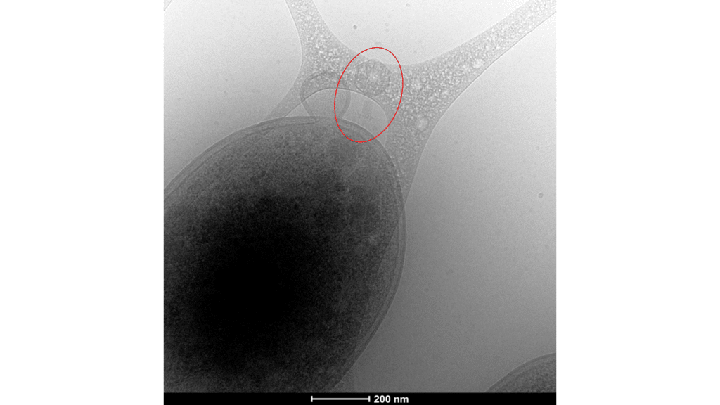 Image showing Parid phages (red circle) have attacked a Pseudomonas cell and multiplied in it. The cell is about to disintegrate.