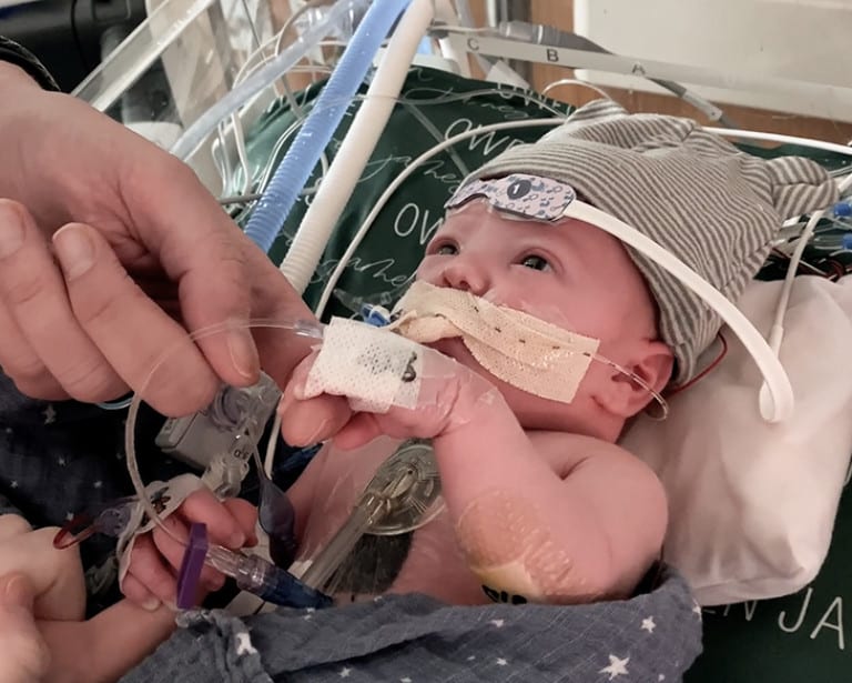 Infant who needed heart valve replacement