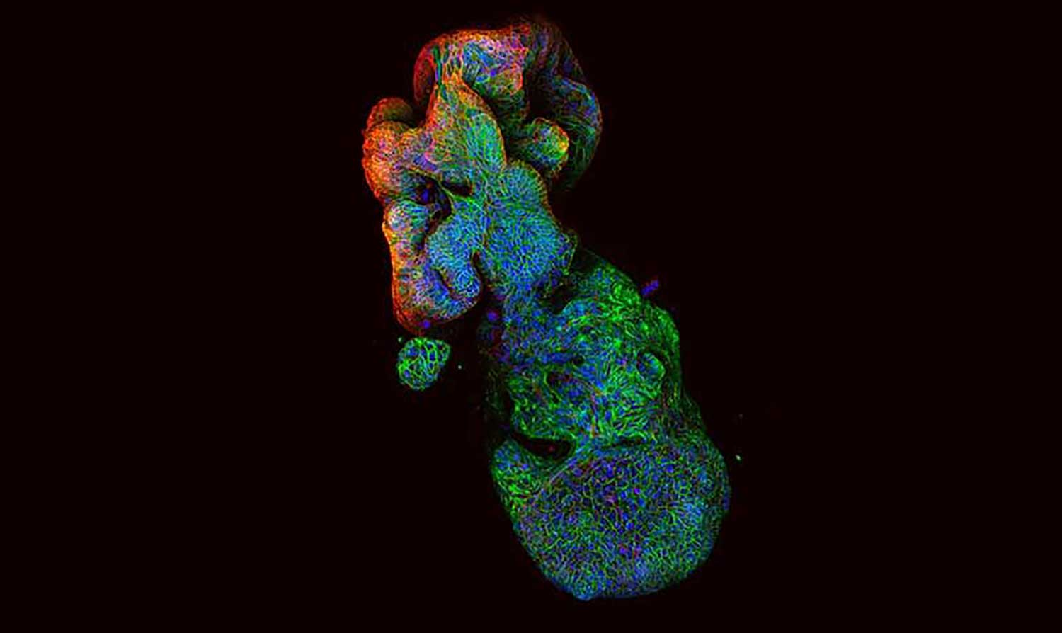 3D structure of an organoid