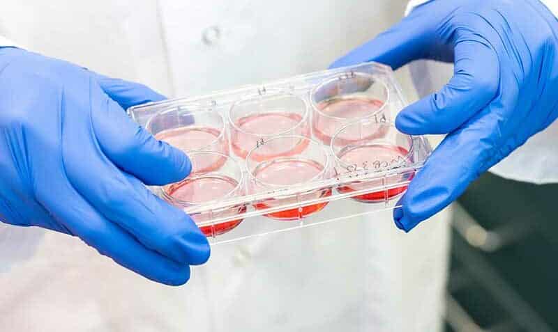 tray containing lab-grown organoids