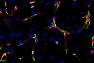 Image showing Blood vessel endothelial cells (green) and basement membrane (red) in the brain.