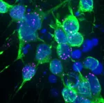 Dopaminergic neurons Dopaminergic neurons